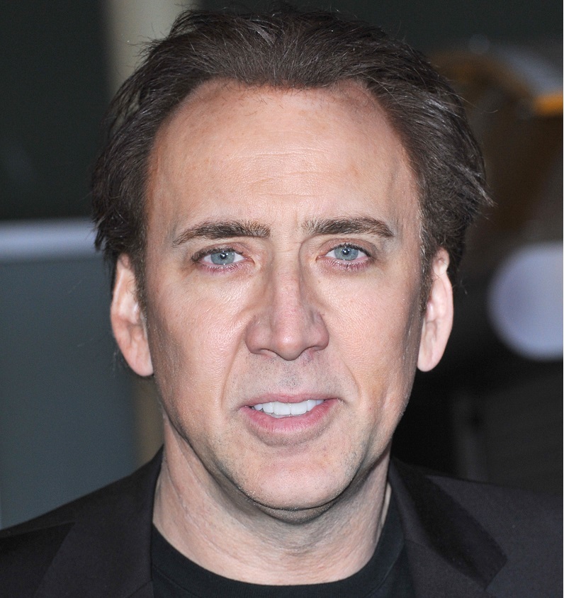 trapianto capelli nicholas cage